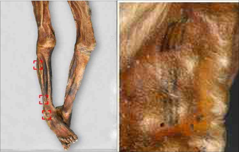<Fig. 1>