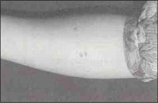 <Fig. 14>